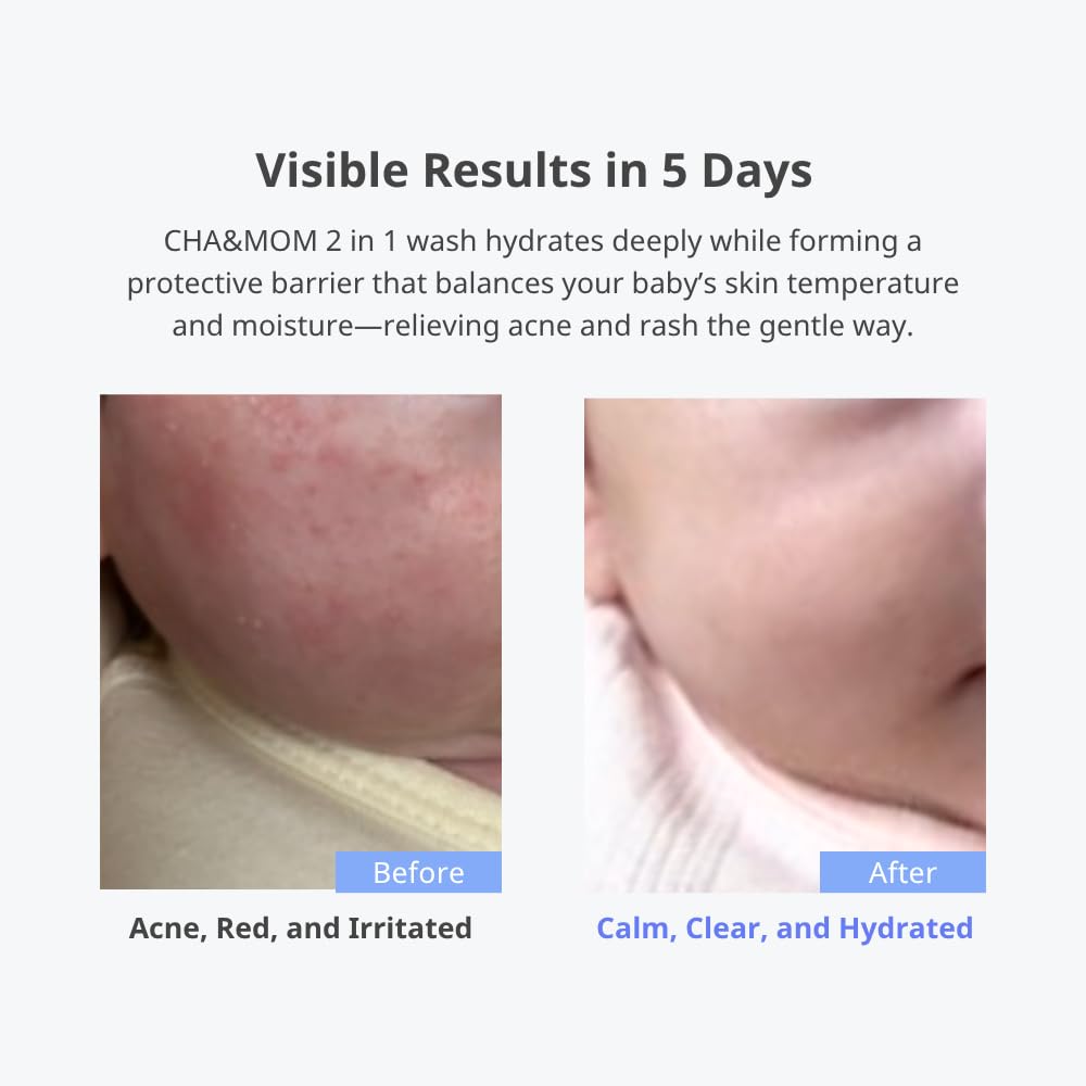 Cha&Mom Head-to-toe Korean Baby Skincare - Hypoallergenic, Plant Based, and Natural Hair & Body Wash, 10.58oz